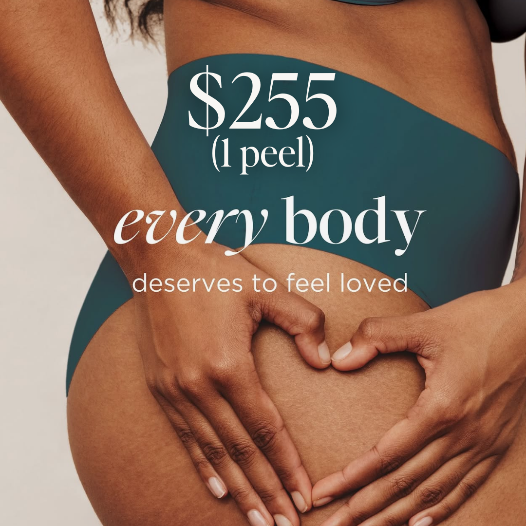 $255 VI Chemical Peel